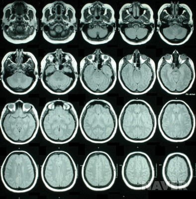 몸의 깊이에 따라 여러 단계로 촬영된 MRI 영상
