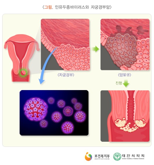 경부전기 이미지
