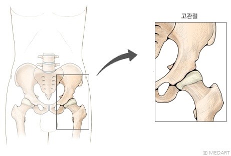 골반과 엉덩관절(고관절)