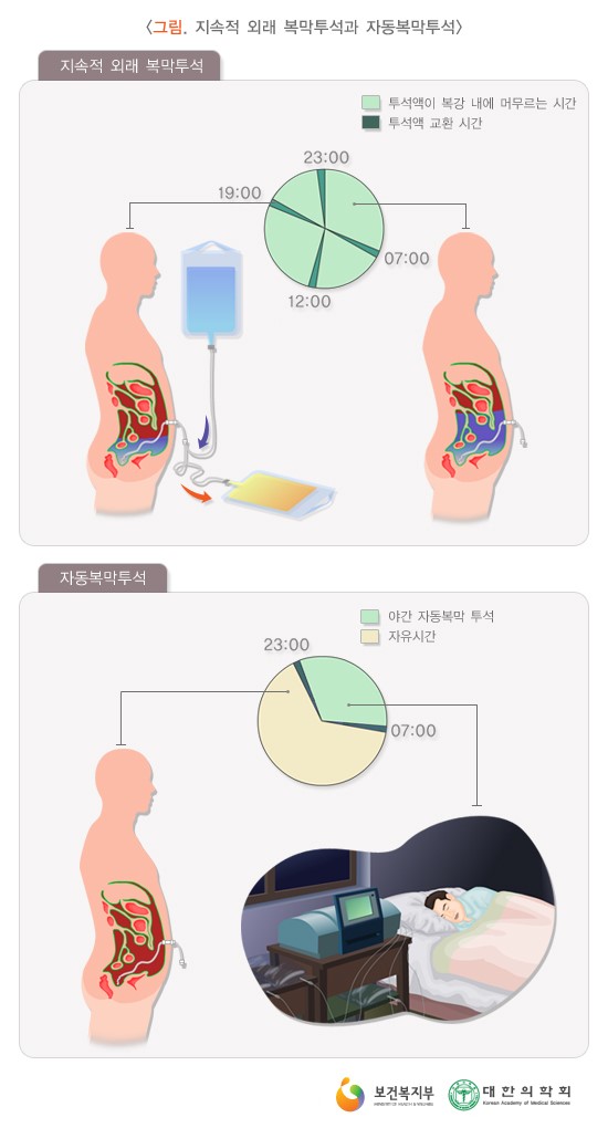 투석 간호 (CRRT + 혈액투석 + 복막투석) : 네이버 블로그
