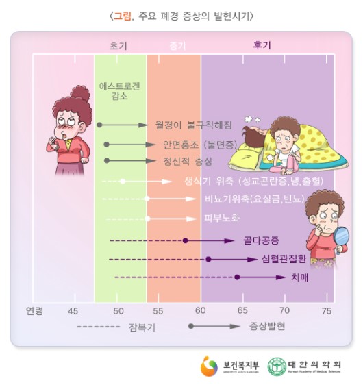 주요 폐경 증상의 발현시기