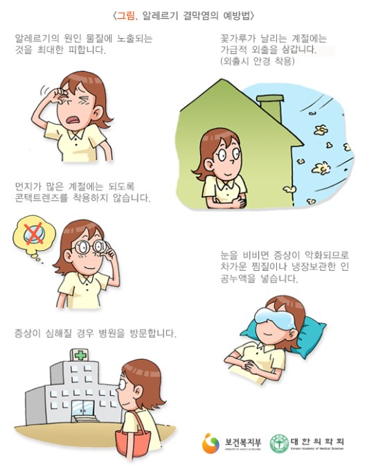 알레르기 결막염의 예방법