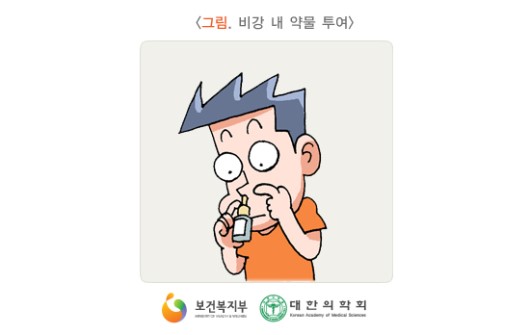 비강 내 약물 투여