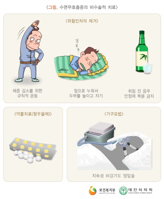 수면무호흡증의 비수술적 치료