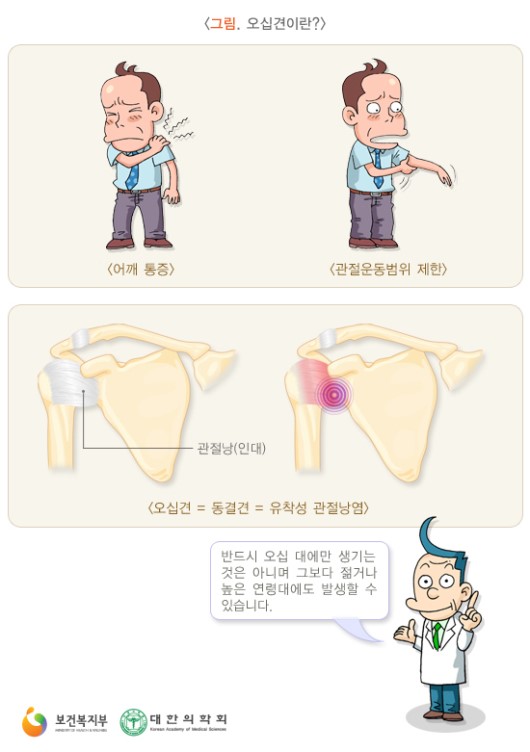오십견이란?