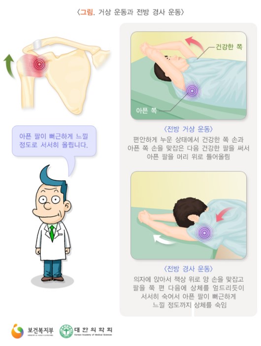 거상 운동과 전방 경사 운동