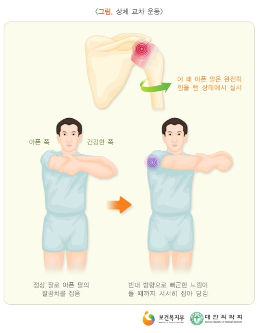 상체 교차 운동