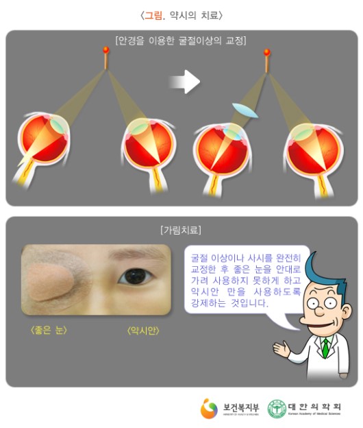 약시의 치료