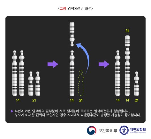 염색체전위 과정