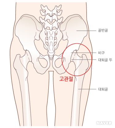 고관절염 - 고관절의 위치