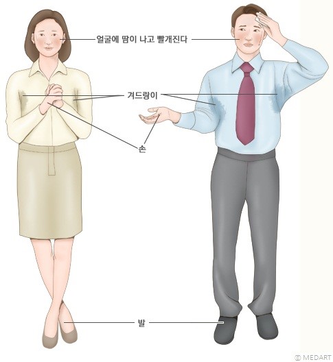 다한증의 증상