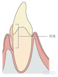 민트치과 이미지
