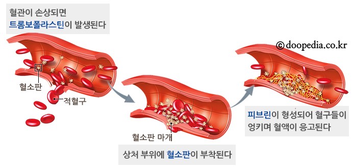 혈액의 구성과 혈액응고에 대해 알아보자, 혈액세포, 지혈과정 : 네이버 블로그