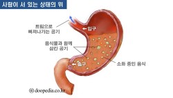 서있는 상태의 위