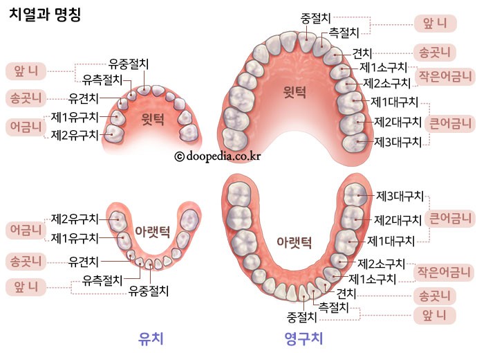 유치 본문 이미지 1