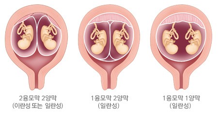 아훔 이미지