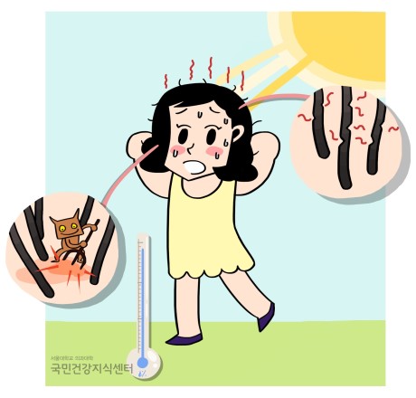 이안두피탈모 이미지