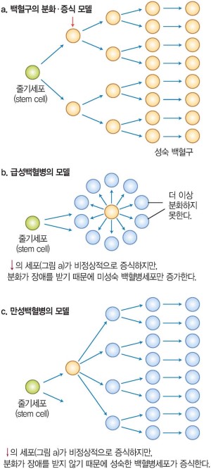 그림 5-2 : 급성백혈병 vs 만성백혈병