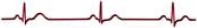 Ⅰ군 : 동성 느린맥(sinus bradycardia)