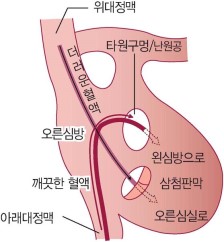 그림 C