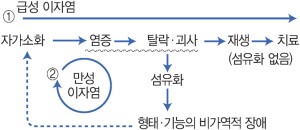 그림 13-1 : 이자염의 기전