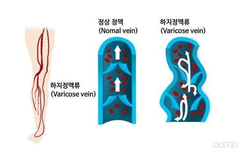 철다리 이미지